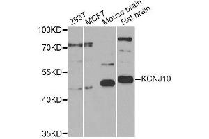 Western blot analysis of extracts of various cell lines, using KCNJ10 Antibody (ABIN6003558) at 1/1000 dilution. (KCNJ10 antibody)