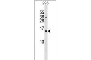 293个细胞系裂解物（35⁄μg/lane）中的SH2D1A抗体（C-term）（ABIN1881802和ABIN2838903）western blot分析。（SH2D1A抗体（C-Term））