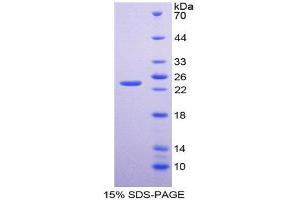 SDS-PAGE (SDS) image for Bcl2 Modifying Factor (BMF) (AA 1-181) protein (His tag) (ABIN1981078)