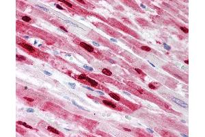 Anti-PLA2G2A antibody IHC of human heart. (PLA2G2A antibody)