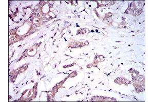 Immunohistochemistry (IHC) image for anti-Bone Morphogenetic Protein Receptor 1A (BMPR1A) (AA 179-378) antibody (ABIN1724745)