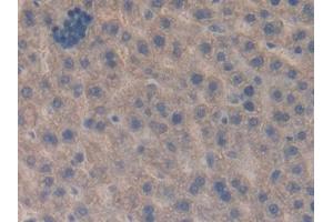 IHC-P analysis of Rat Liver Tissue, with DAB staining. (CTGF antibody)