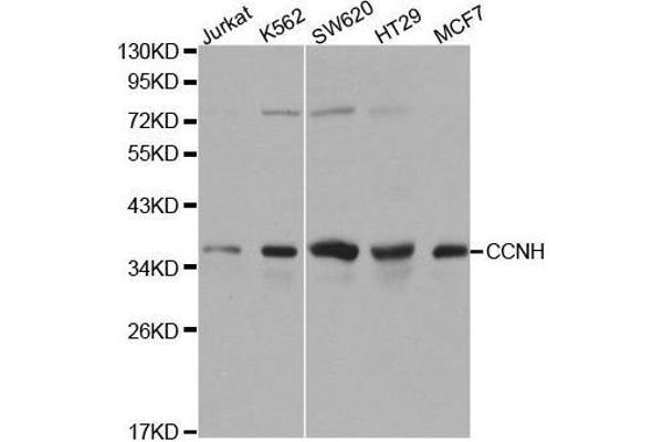 Cyclin H anticorps  (AA 1-323)