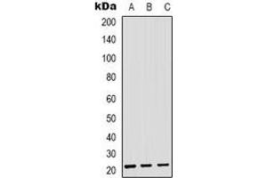 Western blot analysis of SAR1B expression in HEK293T (A), Hela (B), RAW264. (SAR1B antibody)