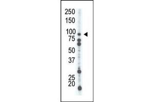 Image no. 1 for anti-phosphofructokinase, Platelet (PFKP) (C-Term) antibody (ABIN360627) (PFKP antibody  (C-Term))