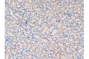 Figure. (MGST1 antibody  (AA 8-155))