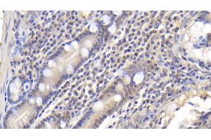 Detection of CDK2AP1 in Human Small intestine Tissue using Polyclonal Antibody to Cyclin Dependent Kinase 2 Associated Protein 1 (CDK2AP1) (CDK2AP1 antibody  (AA 1-115))