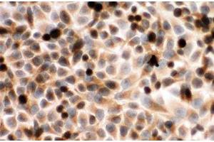 ICC testing of CYPOR antibody and human placenta cells (POR antibody  (C-Term))