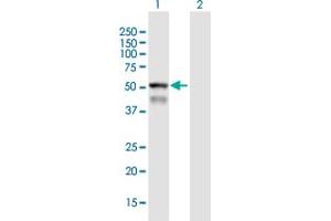 Western Blot analysis of CYP4F8 expression in transfected 293T cell line by CYP4F8 MaxPab polyclonal antibody. (CYP4F8 antibody  (AA 1-520))
