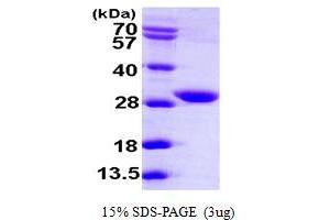 SDS-PAGE (SDS) image for 3-Ketodihydrosphingosine Reductase (KDSR) (AA 26-270) protein (His tag) (ABIN667376)