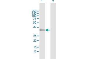 Western Blot analysis of NAT1 expression in transfected 293T cell line by NAT1 MaxPab polyclonal antibody. (NAT1 antibody  (AA 1-290))