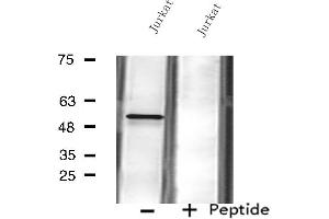 Western blot analysis of extracts from Jurkat cells using FKRP antibody.