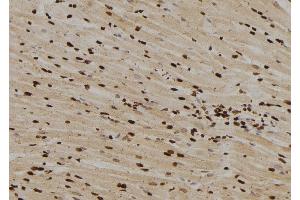 ABIN6263047 and ABIN6276556 at 1/100 staining Rat heart tissue by IHC-P. (MAD1L1 antibody  (N-Term))