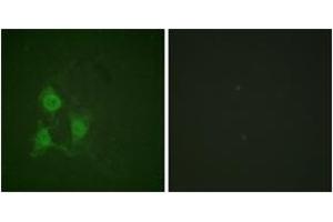Immunofluorescence analysis of A549 cells, using PKA CAT (Phospho-Thr197) Antibody. (PKA CAT (AA 166-215), (pThr198) antibody)