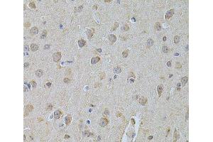 Immunohistochemistry of paraffin-embedded Mouse brain using NME1 Polyclonal Antibody at dilution of 1:200 (40x lens). (NME1 antibody)
