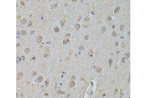 Immunohistochemistry of paraffin-embedded Mouse brain using NME1 Polyclonal Antibody at dilution of 1:200 (40x lens).