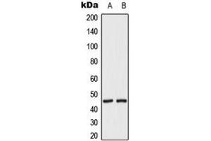 Western blot analysis of MKK2 (pT394) expression in HeLa UV-treated (A), HepG2 UV-treated (B) whole cell lysates.