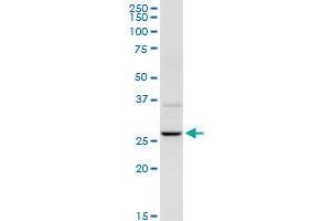 UROS MaxPab rabbit polyclonal antibody. (UROS antibody  (AA 1-265))