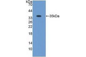 Detection of Recombinant PKCb1, Rabbit using Polyclonal Antibody to Protein Kinase C Beta 1 (PKCb1) (Pkc beta 1 antibody  (AA 342-600))