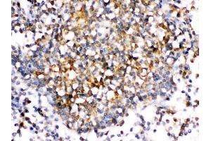 Immunohistochemistry (Paraffin-embedded Sections) (IHC (p)) image for anti-Tumor Necrosis Factor (Ligand) Superfamily, Member 8 (TNFSF8) (AA 63-234) antibody (ABIN3044499)
