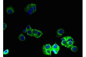 Immunofluorescent analysis of MCF-7 cells using ABIN7153493 at dilution of 1:100 and Alexa Fluor 488-congugated AffiniPure Goat Anti-Rabbit IgG(H+L) (GABRB2 antibody  (AA 26-244))