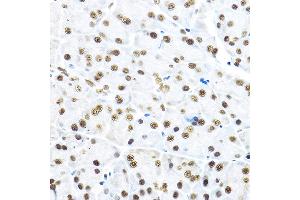 Immunohistochemistry (IHC) image for anti-Nuclear Receptor Subfamily 5, Group A, Member 2 (NR5A2) (AA 1-140) antibody (ABIN6144832)