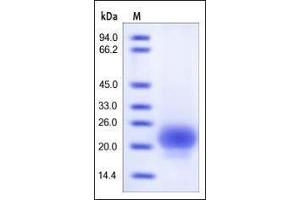 Human R-Spondin 1 (21-146), His Tag on SDS-PAGE under reducing (R) condition. (RSPO1 Protein (AA 21-146) (His tag))