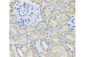 Immunohistochemistry of paraffin-embedded Rat kidney using DCP2 Polyclonal Antibody at dilution of 1:100 (40x lens). (DCP2 antibody)