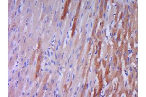 Paraformaldehyde-fixed, paraffin embedded rat heart muscle Antigen retrieval by boiling in sodium citrate buffer (pH6. (Prepro-Endothelin-1 (AA 16-110) antibody)