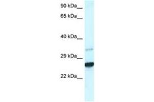 Image no. 1 for anti-Caudal Type Homeobox 1 (CDX1) (AA 195-244) antibody (ABIN6747429) (CDX1 antibody  (AA 195-244))