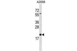 BLOC1S3 Antibody (C-term) (ABIN1881114 and ABIN2838858) western blot analysis in  cell line lysates (35 μg/lane).