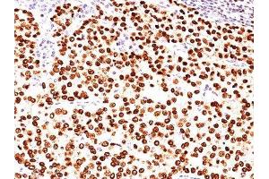 Image no. 1 for anti-Placenta Growth Factor (PGF) antibody (ABIN6189231) (PLGF antibody)
