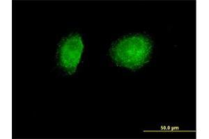 Immunofluorescence (IF) image for anti-Sorting Nexin 1 (SNX1) (AA 1-522) antibody (ABIN948488)