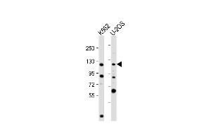 All lanes : Anti-NOP2 Antibody (N-Term) at 1:2000 dilution Lane 1: K562 whole cell lysate Lane 2: U-2OS whole cell lysate Lysates/proteins at 20 μg per lane.