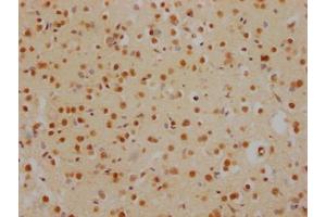 Immunohistochemistry (IHC) image for anti-Histone Deacetylase 2 (HDAC2) antibody (ABIN7127538)