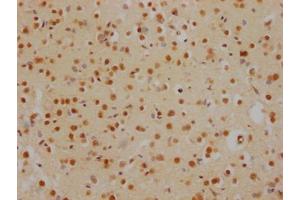 IHC image of ABIN7127538 diluted at 1:100 and staining in paraffin-embedded human brain tissue performed on a Leica BondTM system. (Recombinant HDAC2 antibody)