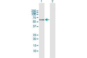 Western Blot analysis of MAOA expression in transfected 293T cell line by MAOA MaxPab polyclonal antibody. (Monoamine Oxidase A antibody  (AA 1-527))