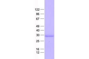 Validation with Western Blot (PPT1 Protein (His tag))