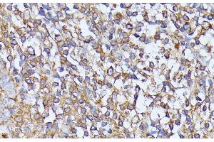 Immunohistochemistry of paraffin-embedded Human tonsil using STK24 Polyclonal Antibody at dilution of 1:100 (40x lens). (STK24 antibody)