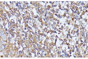 Immunohistochemistry of paraffin-embedded Human tonsil using STK24 Polyclonal Antibody at dilution of 1:100 (40x lens).