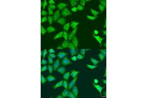 Immunofluorescence analysis of U2OS cells using EIF2AK2 antibody. (EIF2AK2 antibody  (AA 1-270))