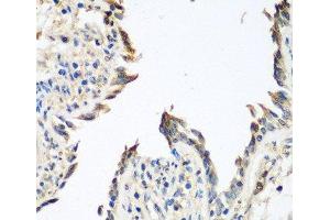 Immunohistochemistry of paraffin-embedded Human lung using GPI Polyclonal Antibody at dilution of 1:100 (40x lens). (GPI antibody)
