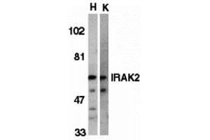 Western Blotting (WB) image for anti-Interleukin-1 Receptor-Associated Kinase 2 (IRAK2) antibody (ABIN1030204) (IRAK2 antibody)