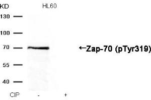 Western blot analysis of extracts from HL60 cells, treated with calf intestinal phosphatase (CIP), using Zap-70 (Phospho-Tyr319) Antibody. (ZAP7 (pTyr319) antibody)