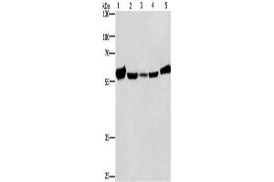 Gel: 8 % SDS-PAGE, Lysate: 40 μg, Lane 1-5: Mouse liver tissue, Raji cells, hela cells, hepG2 cells, A549 cells, Primary antibody: ABIN7128790(CAT Antibody) at dilution 1/266. (Catalase antibody)