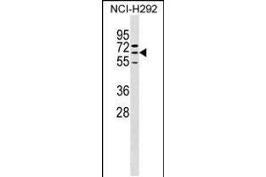 Western blot analysis in NCI-H292 cell line lysates (35ug/lane). (ZNF599 antibody  (N-Term))