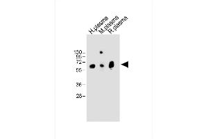 All lanes : Anti-T Antibody (Center) at 1:2000 dilution Lane 1: Human plasma whole lysate Lane 2: Mouse plasma whole lysate Lane 3: Rat plasma whole lysate Lysates/proteins at 20 μg per lane. (PLAT antibody  (AA 371-399))