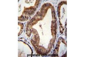 Immunohistochemistry (IHC) image for anti-SHQ1 Homolog (SHQ1) antibody (ABIN2996338) (SHQ1 antibody)
