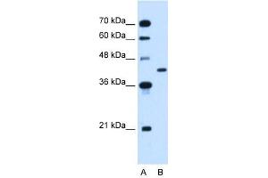 GOT2 antibody used at 2. (GOT2 antibody)