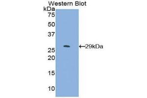 Western Blotting (WB) image for anti-SMAD Family Member 4 (SMAD4) (AA 323-552) antibody (ABIN1860591) (SMAD4 antibody  (AA 323-552))